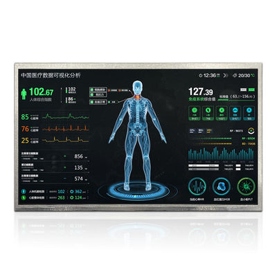 13.3 นิ้ว 1000 นิท EDP TFT LCD Display 1920*1080 พิกเซล 30Pins หน้าจอขนาดใหญ่